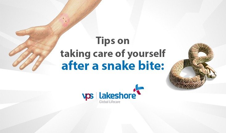 Tips on taking care of yourself after a snake bite