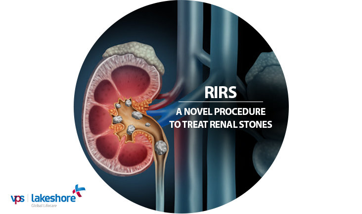 RIRS: A Novel Procedure to Treat Renal Stones