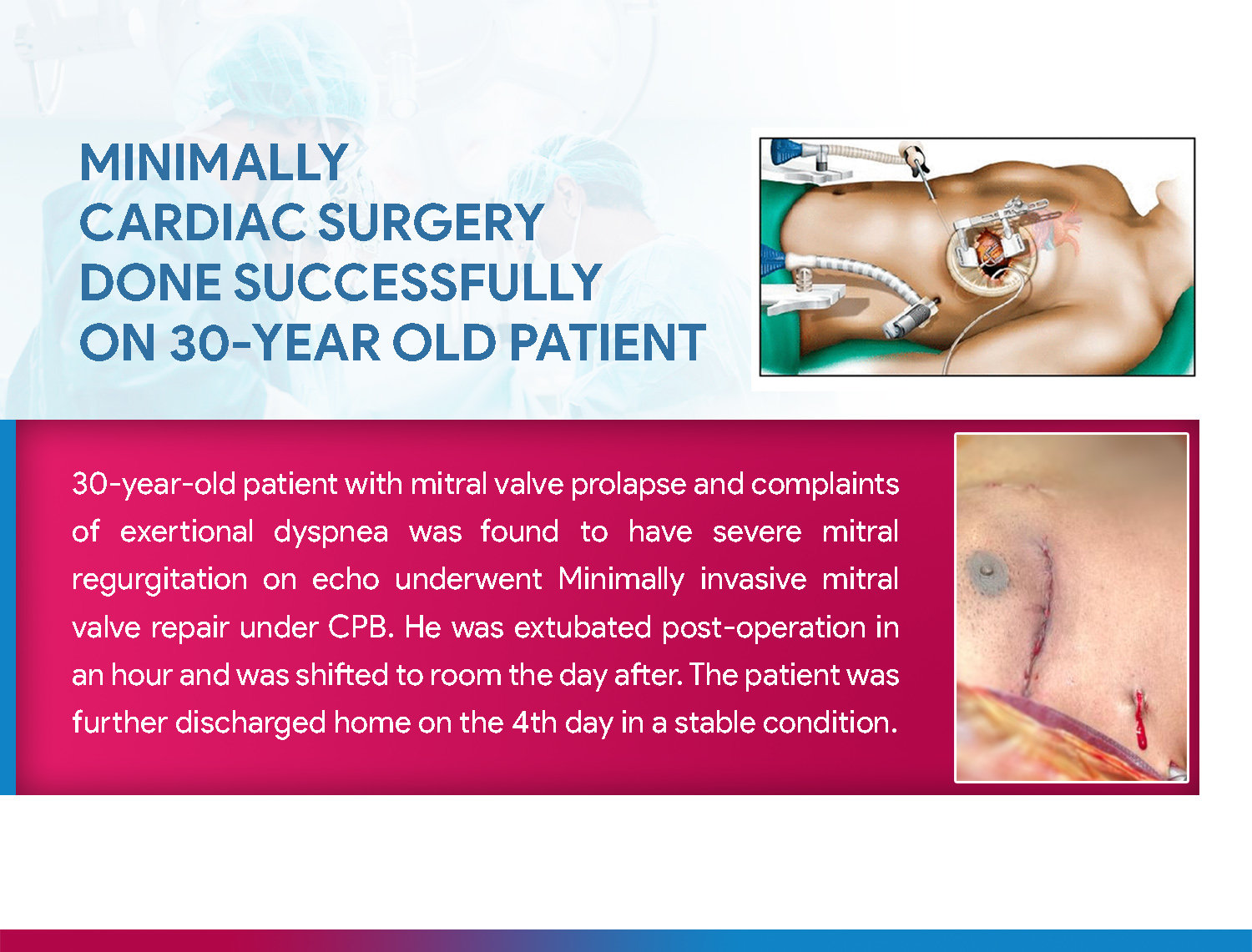 Minimally Invasive Cardiac Surgery done successfully