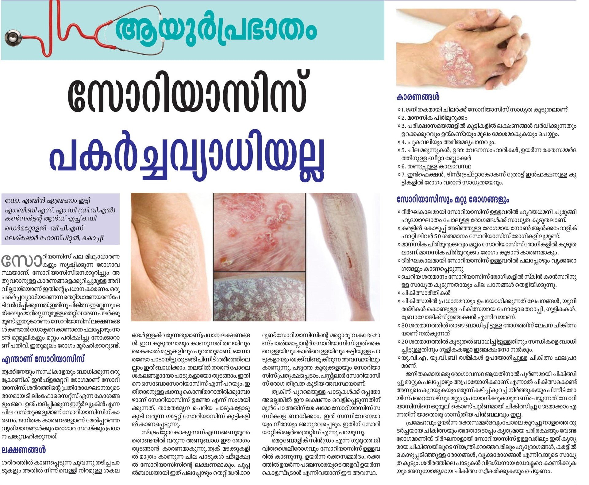 Psoriasis : Symptoms, Causes and Treatment