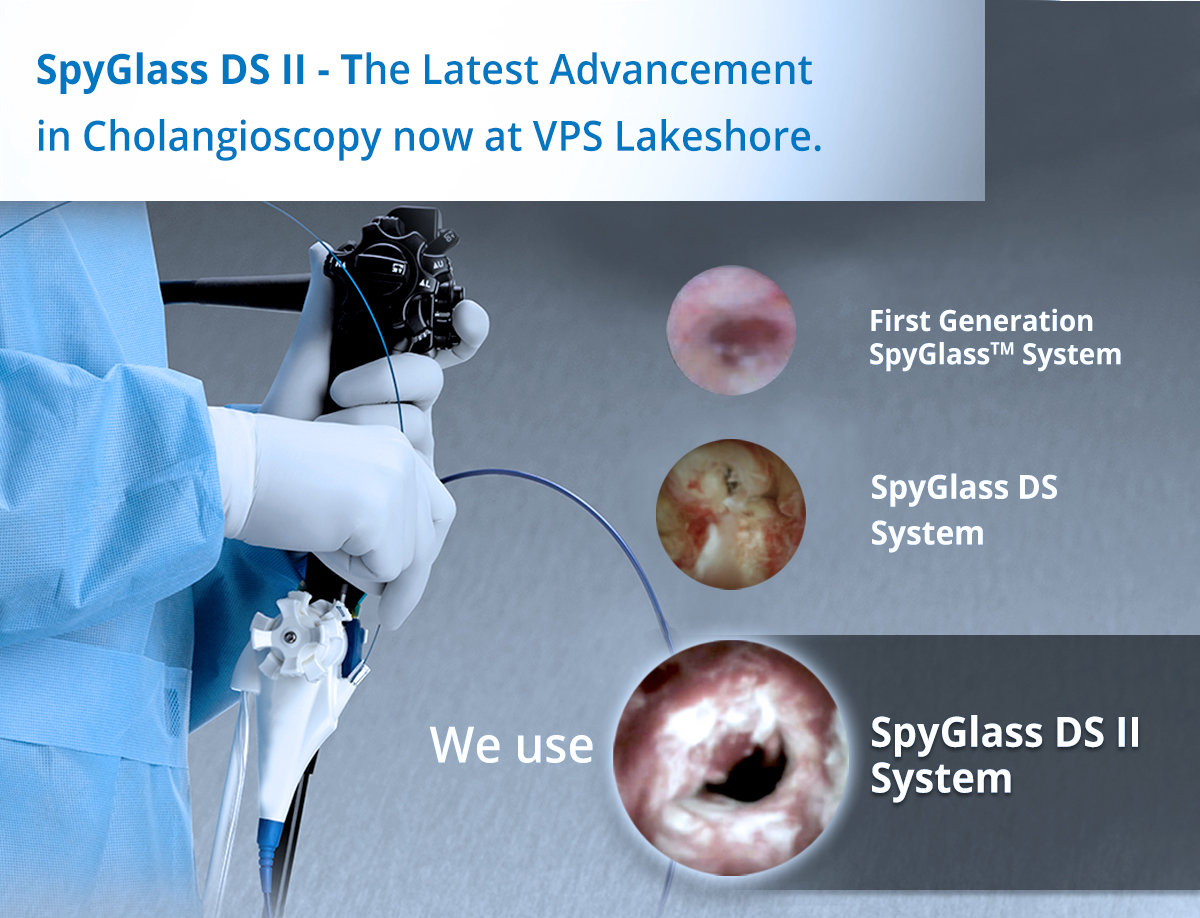 Spyglass DS II - The latest Advancement in Cholangioscopy now at VPS Lakeshore