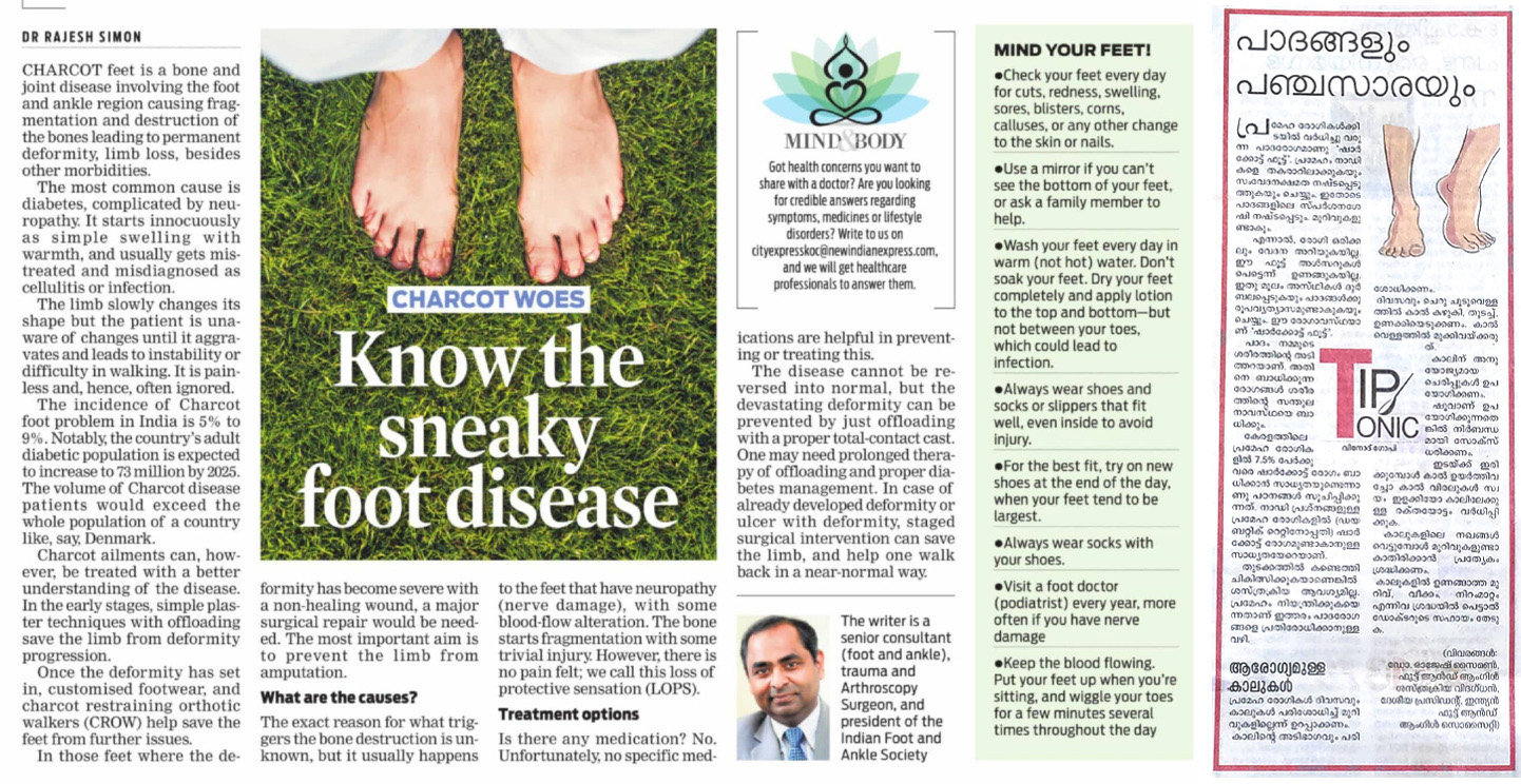 Dr. Rajesh Simon writes about Charcot Foot
