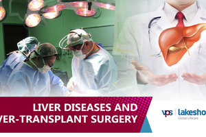 uploads/video/liverdiseasesandliver-transplantsurgery-vpslakeshore-cpeghjNeAuUfB91.jpg